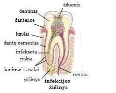Dantų &scaron;aknų infekcija