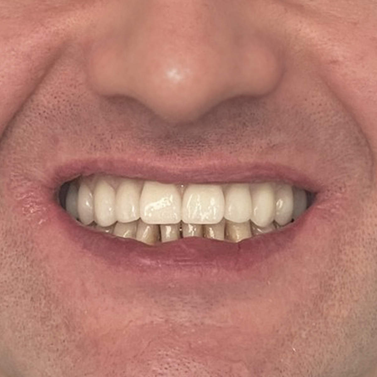 Visi ant 4 sypsena po Rimas