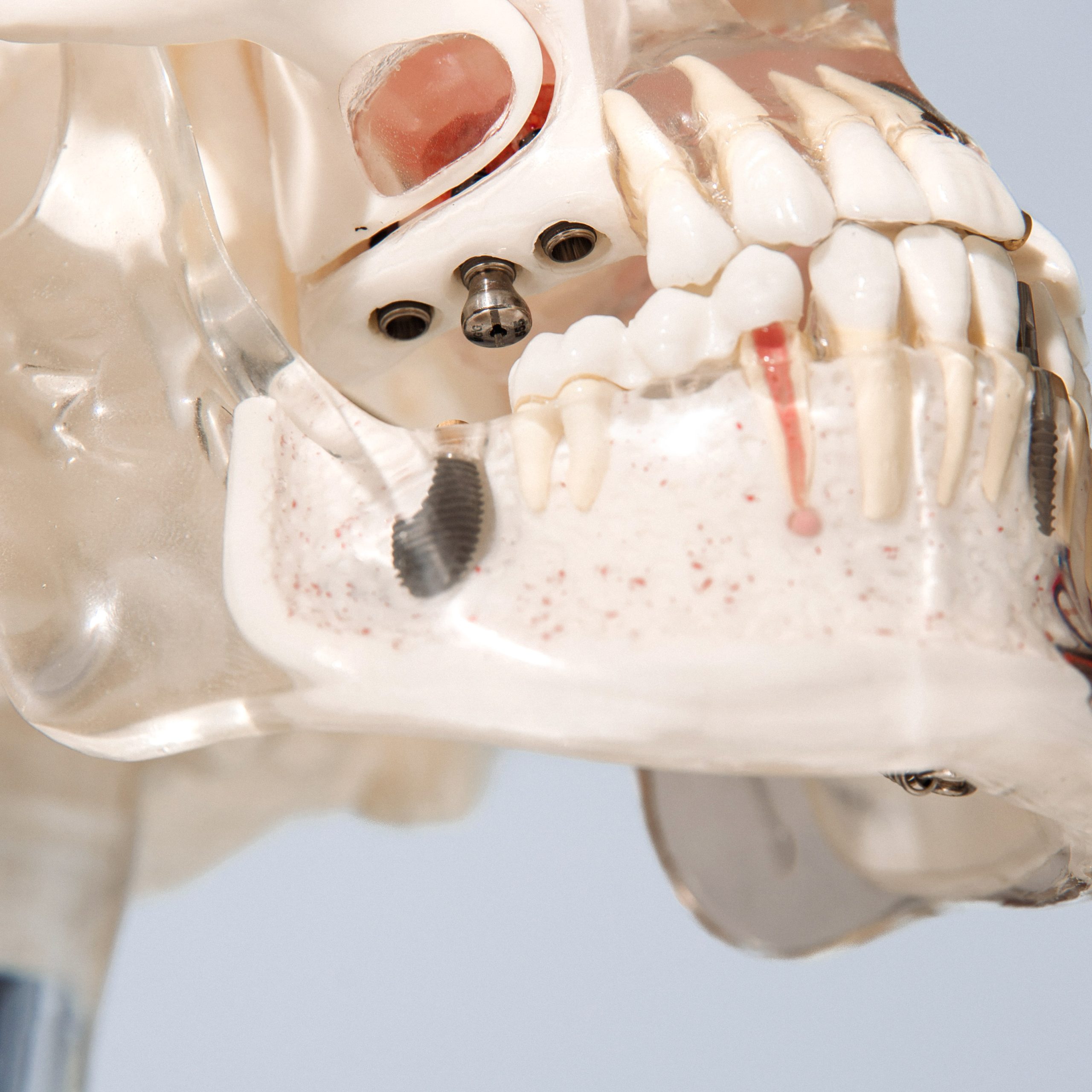 Žandikaulio kaulo augmentacija