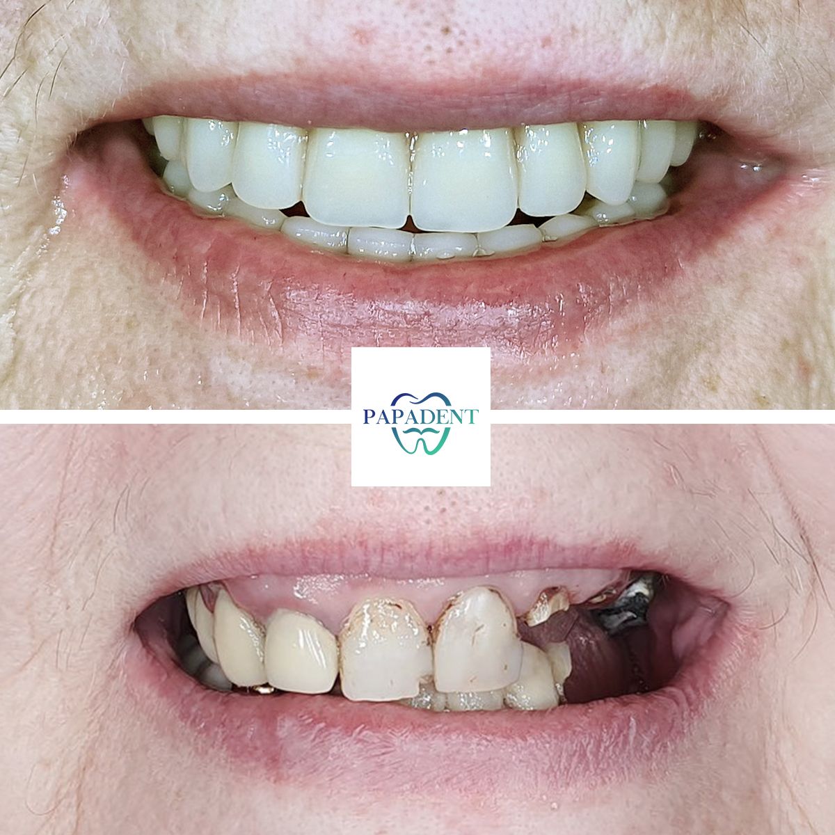 natalija pries ir po 2