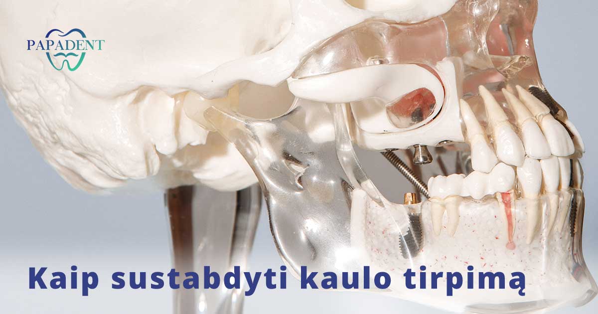 Kaip sustabdyti kaulo tirpimą