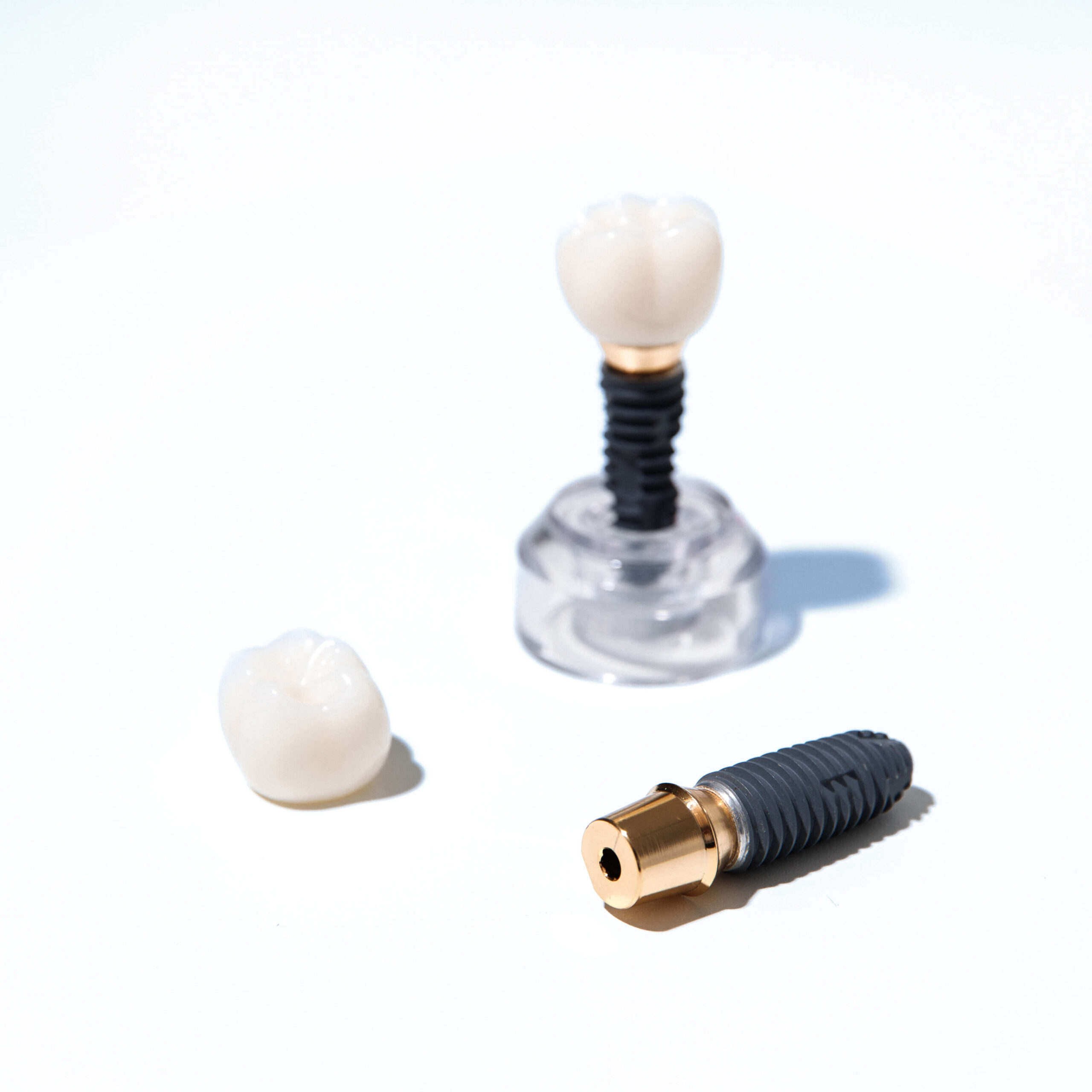 Dantų implantų kompensavimas