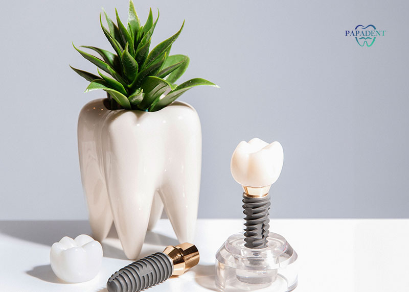 Odontologijos klinika Vilniuje Papadent