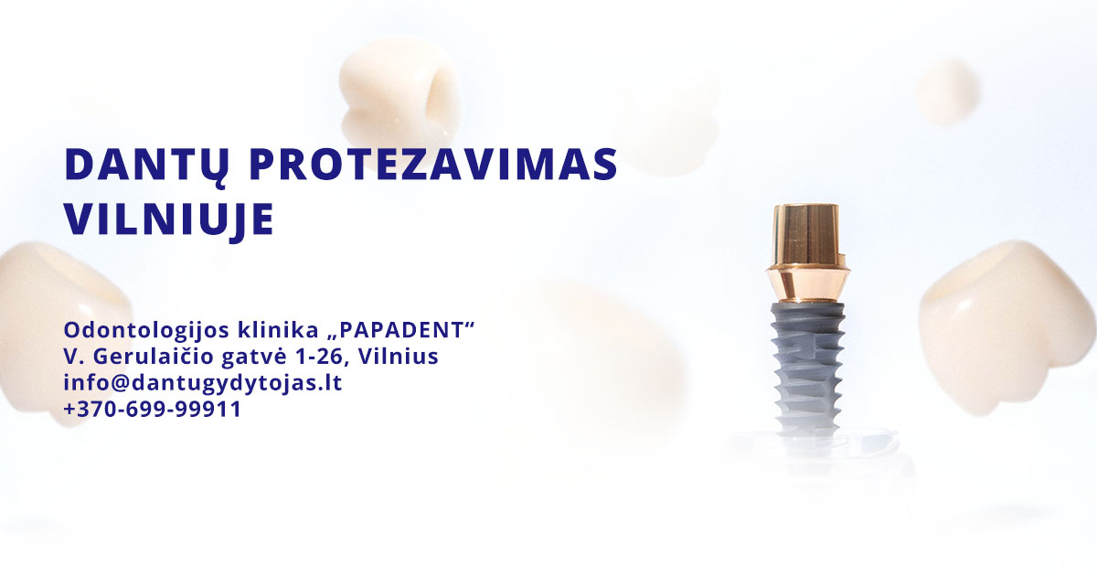 Dantų protezavimas Vilniuje