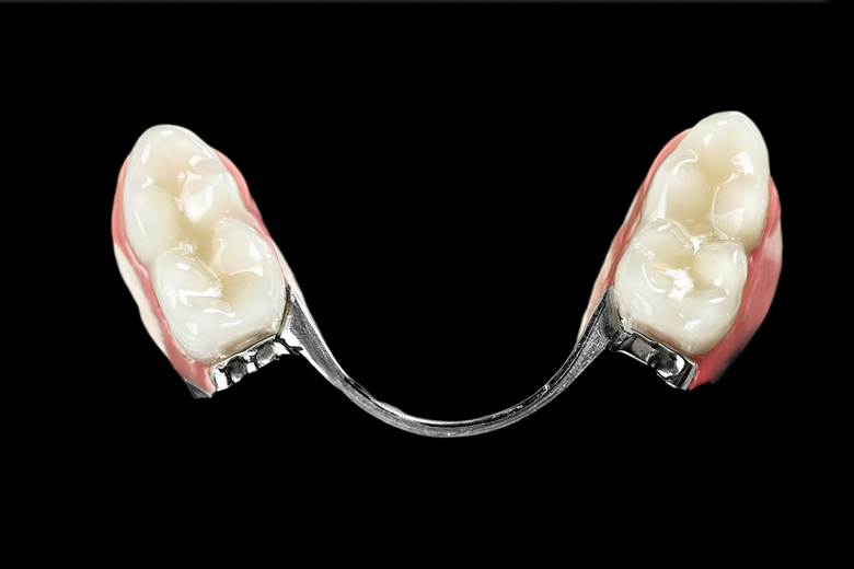 Lanko atraminiai protezai (biugeliai)