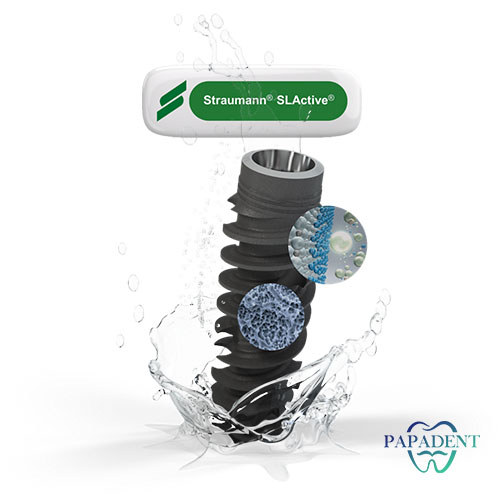 Straumann SLActive dantų implantas