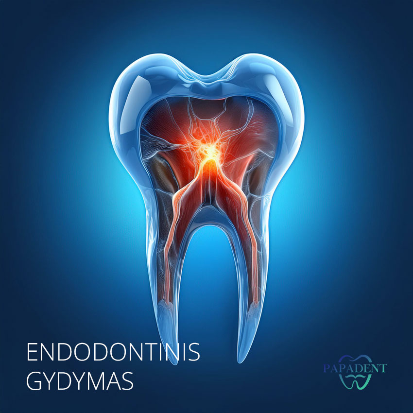 Endodontija