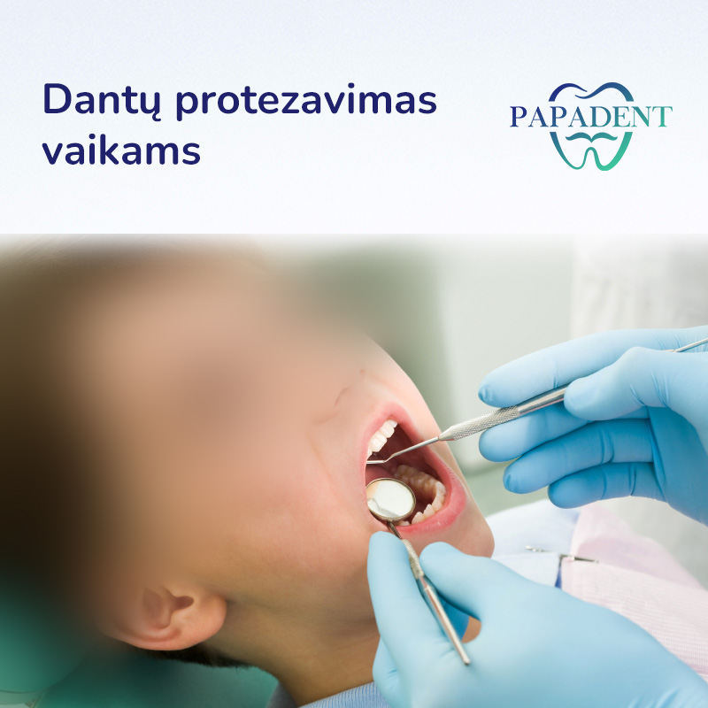 Dantų protezavimas vaikams