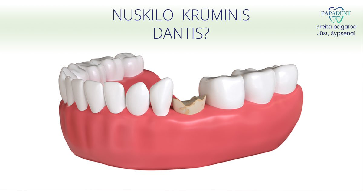 Nuskilo krūminis dantis
